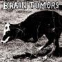 Image: Brain Tumors - S/T
